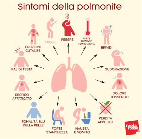 sintomi della polmonite virale